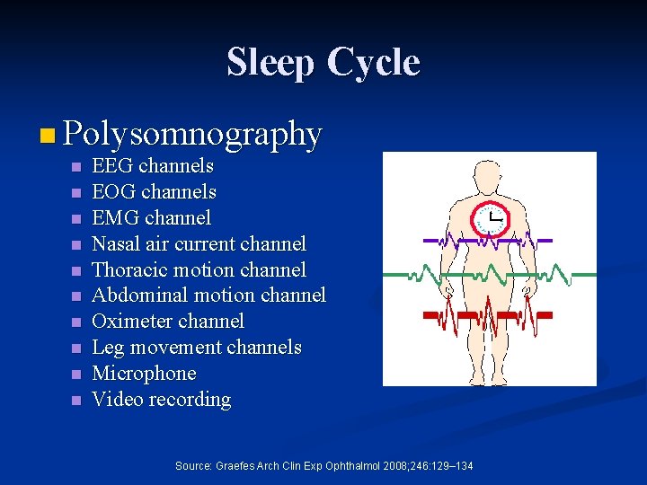 Sleep Cycle n Polysomnography n n n n n EEG channels EOG channels EMG