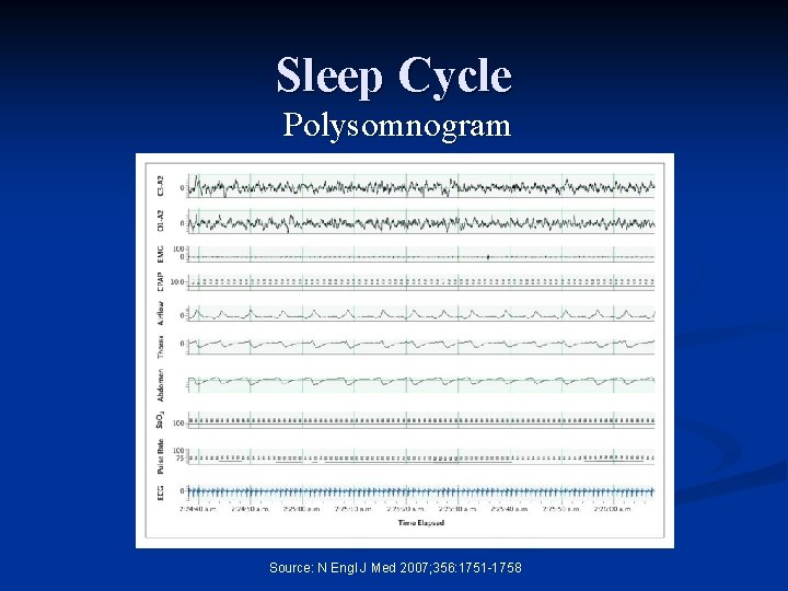 Sleep Cycle Polysomnogram Source: N Engl J Med 2007; 356: 1751 -1758 
