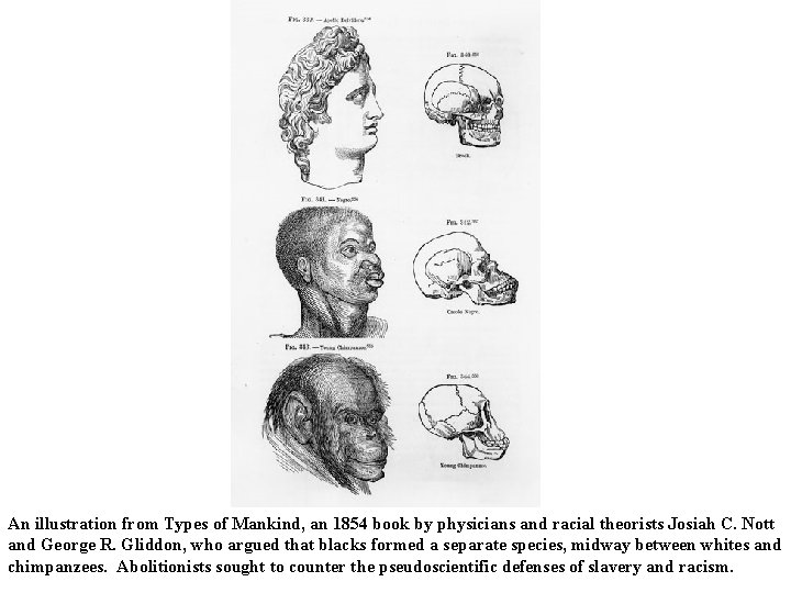 An illustration from Types of Mankind, an 1854 book by physicians and racial theorists