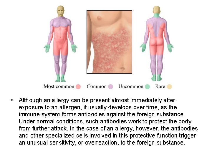  • Although an allergy can be present almost immediately after exposure to an