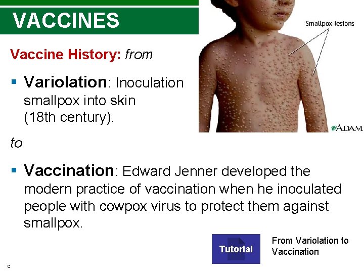 VACCINES Vaccine History: from § Variolation: Inoculation of smallpox into skin (18 th century). VACCINES Vaccine History: from § Variolation: Inoculation of smallpox into skin (18 th century).