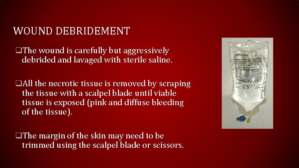 WOUND DEBRIDEMENT q. The wound is carefully but aggressively debrided and lavaged with sterile