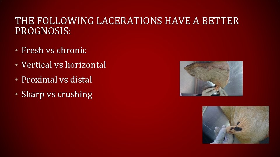THE FOLLOWING LACERATIONS HAVE A BETTER PROGNOSIS: • Fresh vs chronic • Vertical vs