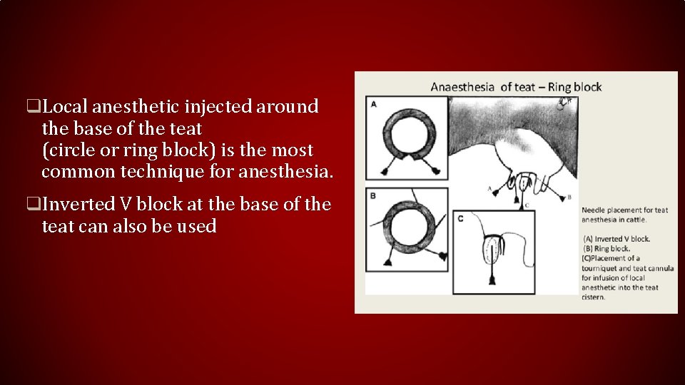 q. Local anesthetic injected around the base of the teat (circle or ring block)