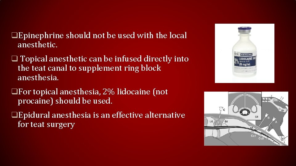 q. Epinephrine should not be used with the local anesthetic. q Topical anesthetic can