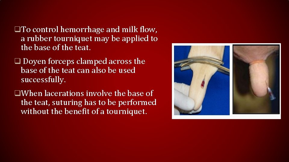 q. To control hemorrhage and milk flow, a rubber tourniquet may be applied to