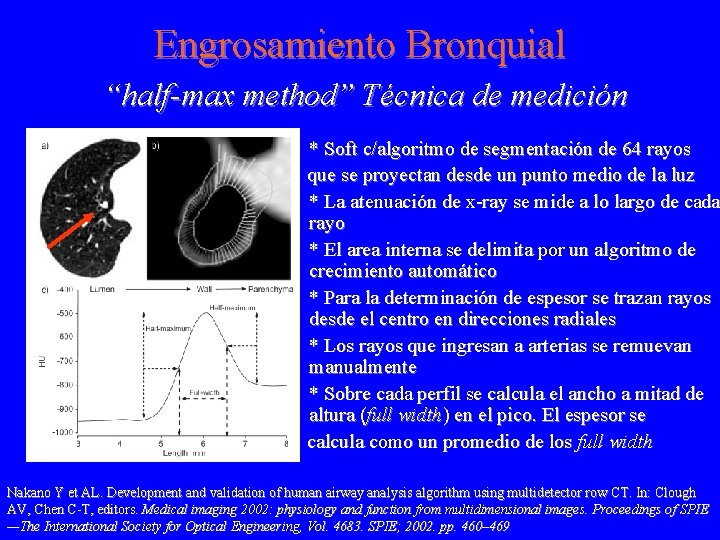 Engrosamiento Bronquial “half-max method” Técnica de medición * Soft c/algoritmo de segmentación de 64