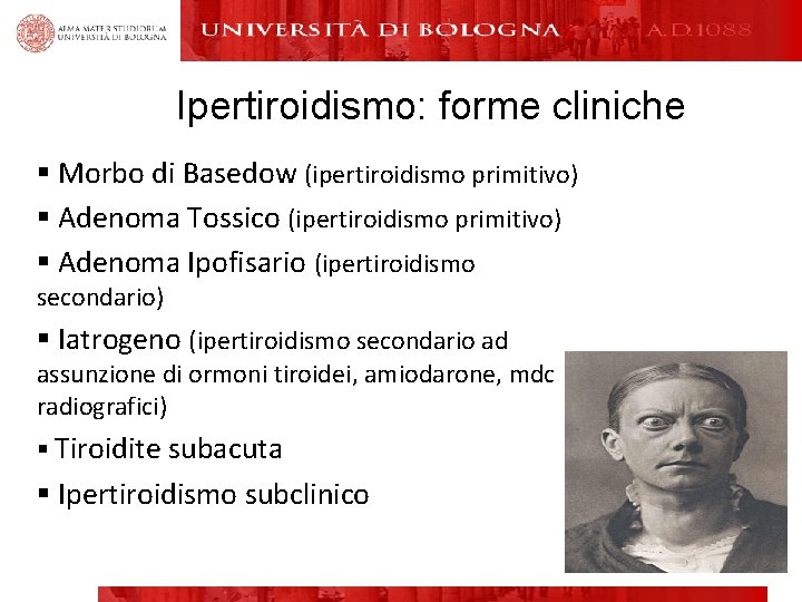 Ipertiroidismo: forme cliniche § Morbo di Basedow (ipertiroidismo primitivo) § Adenoma Tossico (ipertiroidismo primitivo)