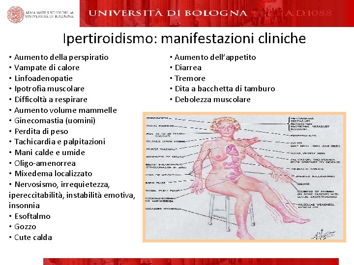 Ipertiroidismo: manifestazioni cliniche • Aumento della perspiratio • Vampate di calore • Linfoadenopatie •