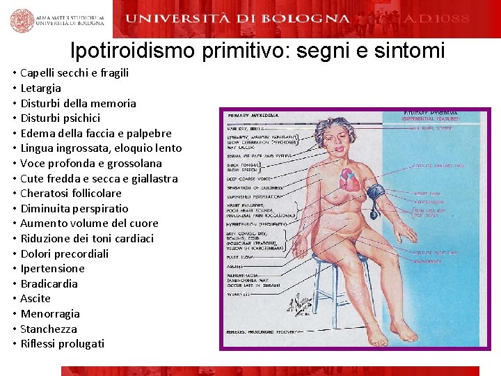 Ipotiroidismo primitivo: segni e sintomi • Capelli secchi e fragili • Letargia • Disturbi