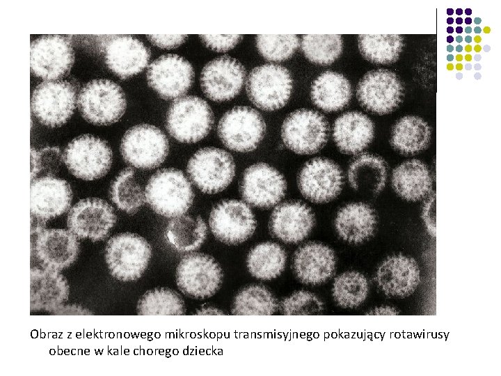 Obraz z elektronowego mikroskopu transmisyjnego pokazujący rotawirusy obecne w kale chorego dziecka 