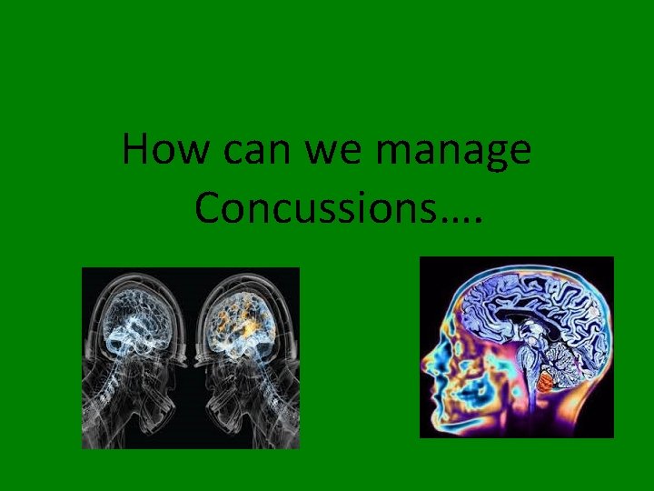 How can we manage Concussions…. 