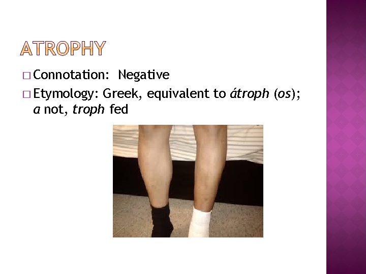 � Connotation: Negative � Etymology: Greek, equivalent to átroph (os); a not, troph fed