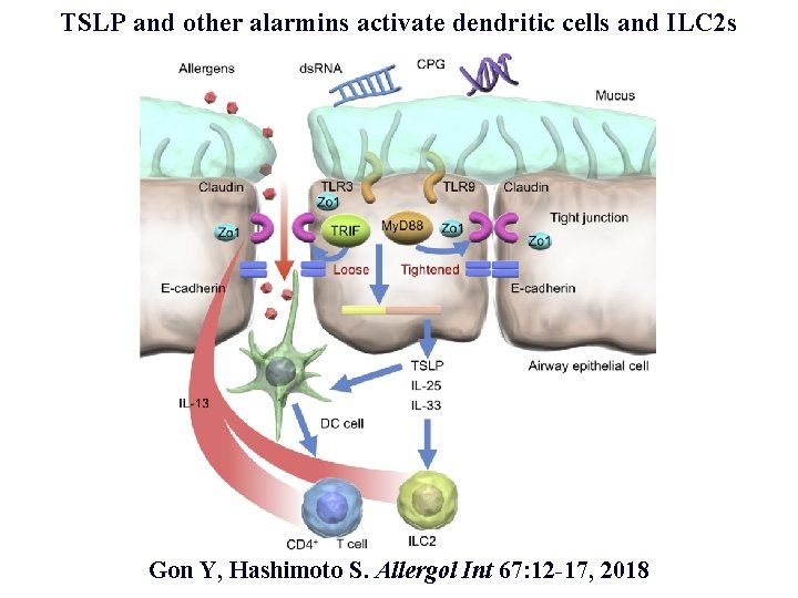 TSLP and other alarmins activate dendritic cells and ILC 2 s Gon Y, Hashimoto
