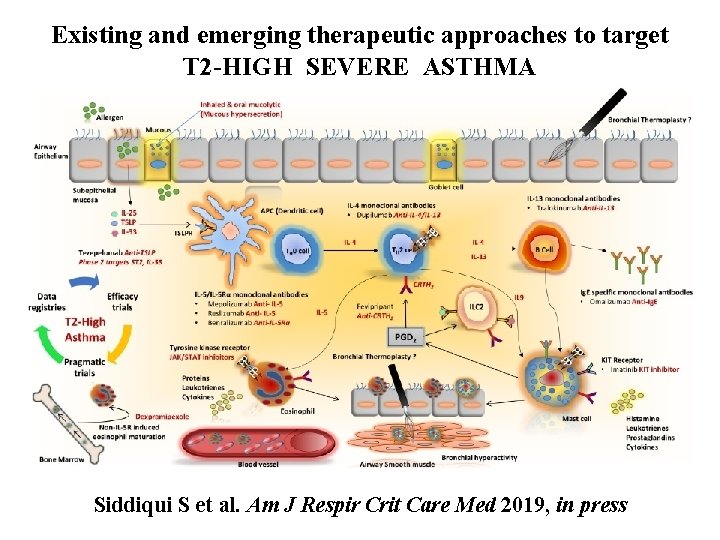 Existing and emerging therapeutic approaches to target T 2 -HIGH SEVERE ASTHMA Siddiqui S