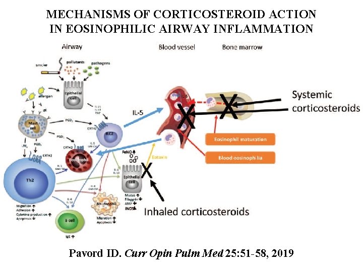 MECHANISMS OF CORTICOSTEROID ACTION IN EOSINOPHILIC AIRWAY INFLAMMATION Pavord ID. Curr Opin Pulm Med