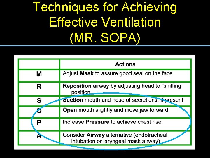 Techniques for Achieving Mnemonic for remembering the six steps for improving efficacy Ventilation of