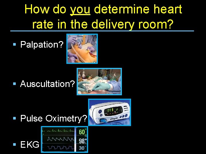 How do you determine heart rate in the delivery room? § Palpation? § Auscultation?