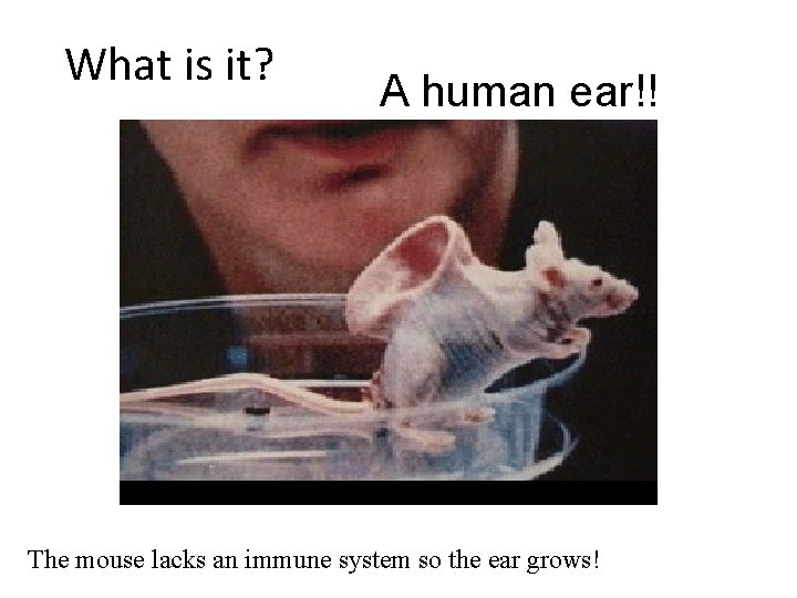 What is it? A human ear!! The mouse lacks an immune system so the