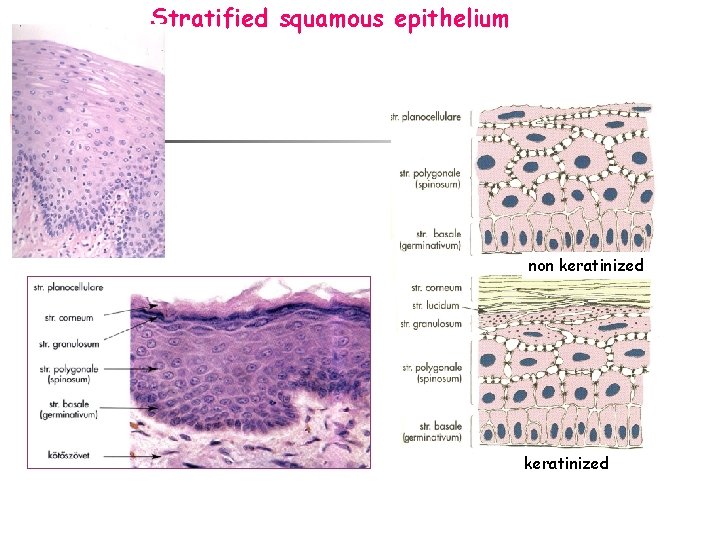 Stratified squamous epithelium non keratinized 