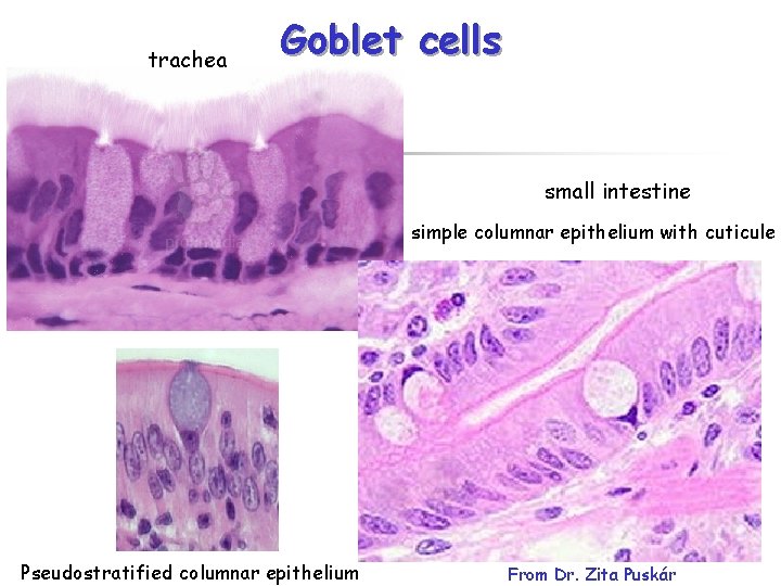 trachea Goblet cells small intestine simple columnar epithelium with cuticule Pseudostratified columnar epithelium From
