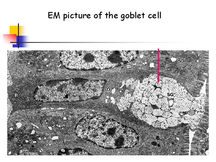 EM picture of the goblet cell 