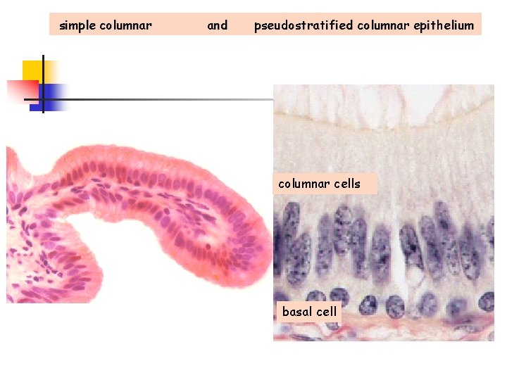 simple columnar and pseudostratified columnar epithelium columnar cells basal cell 
