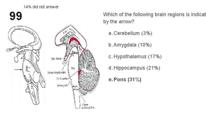 14% did not answer 99 Which of the following brain regions is indicat by 14% did not answer 99 Which of the following brain regions is indicat by