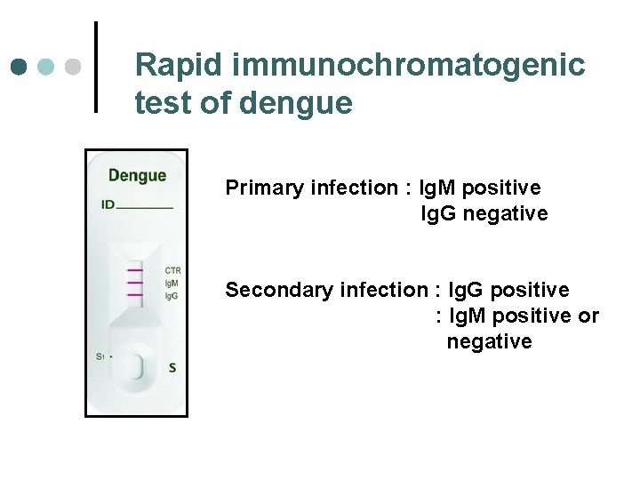 Rapid immunochromatogenic test of dengue Primary infection : Ig. M positive Ig. G negative