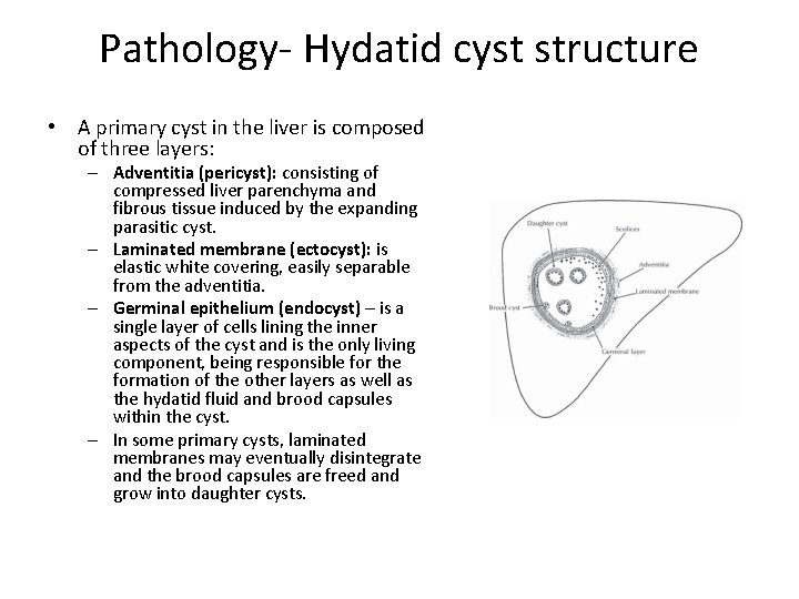 Pathology- Hydatid cyst structure • A primary cyst in the liver is composed of Pathology- Hydatid cyst structure • A primary cyst in the liver is composed of