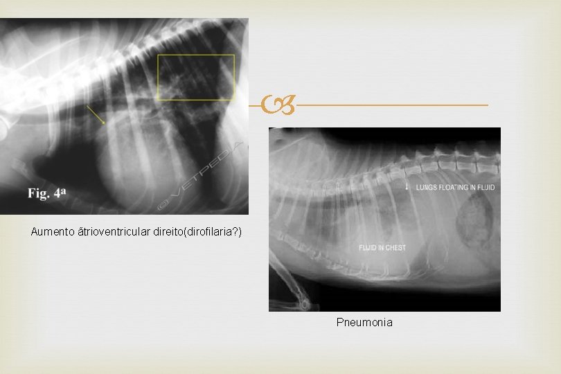  Aumento ãtrioventricular direito(dirofilaria? ) Pneumonia 