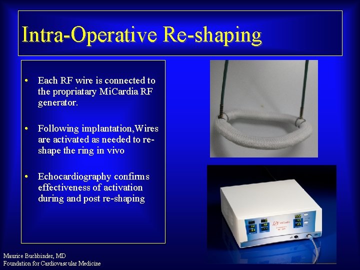 Intra-Operative Re-shaping • Each RF wire is connected to the propriatary Mi. Cardia RF