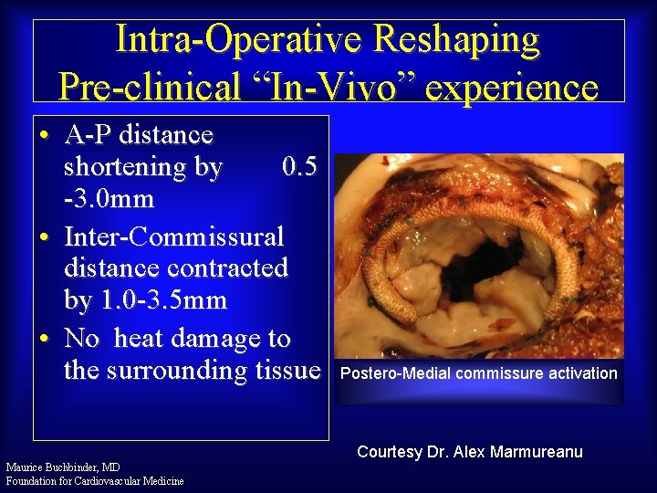 Intra-Operative Reshaping Pre-clinical “In-Vivo” experience • A-P distance shortening by 0. 5 -3. 0