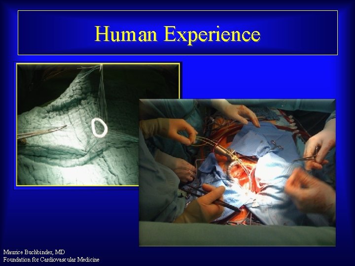 Human Experience Maurice Buchbinder, MD Foundation for Cardiovascular Medicine 