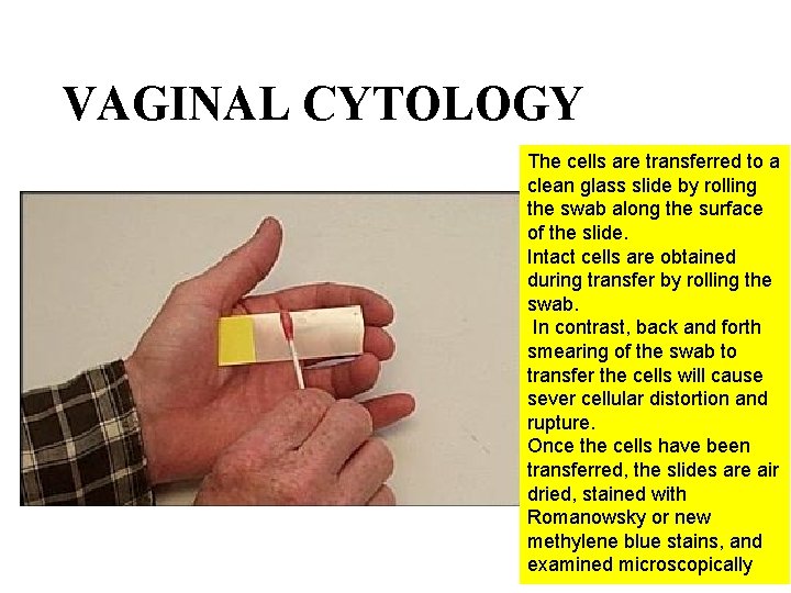VAGINAL CYTOLOGY The cells are transferred to a clean glass slide by rolling the VAGINAL CYTOLOGY The cells are transferred to a clean glass slide by rolling the