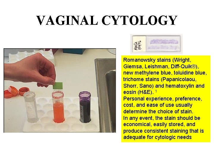 VAGINAL CYTOLOGY Romanowsky stains (Wright, Giemsa, Leishman, Diff-Quik®), new methylene blue, toluidine blue, trichome VAGINAL CYTOLOGY Romanowsky stains (Wright, Giemsa, Leishman, Diff-Quik®), new methylene blue, toluidine blue, trichome