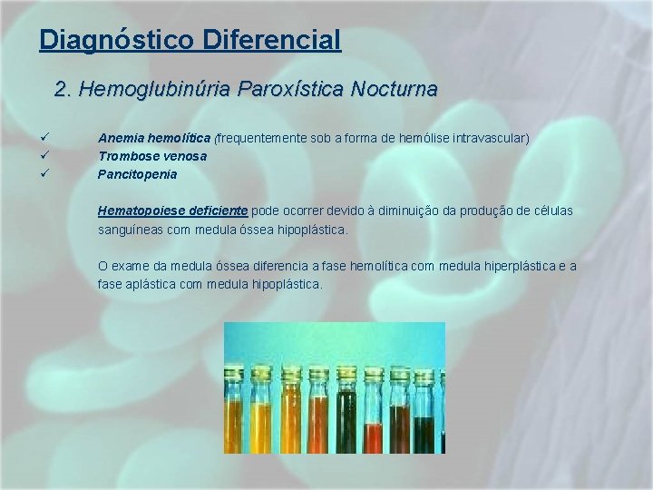 Diagnóstico Diferencial 2. Hemoglubinúria Paroxística Nocturna Anemia hemolítica (frequentemente sob a forma de hemólise Diagnóstico Diferencial 2. Hemoglubinúria Paroxística Nocturna Anemia hemolítica (frequentemente sob a forma de hemólise