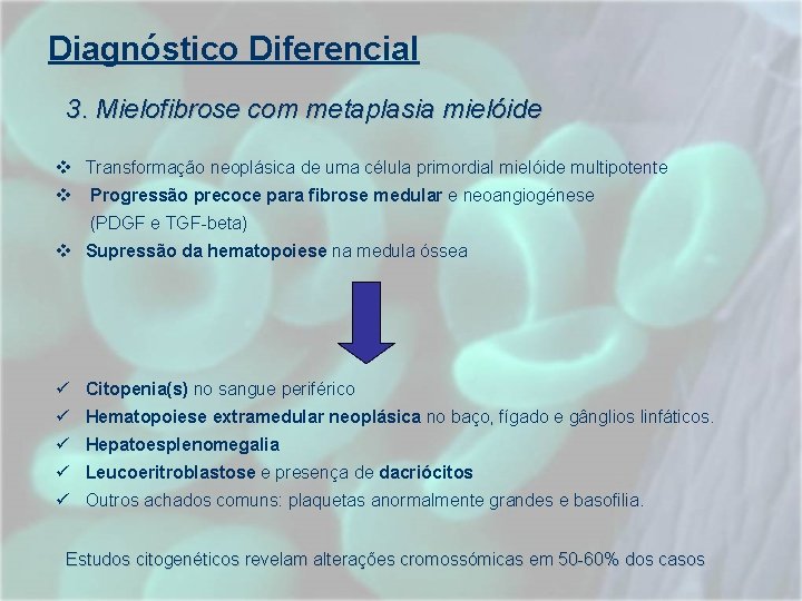 Diagnóstico Diferencial 3. Mielofibrose com metaplasia mielóide v Transformação neoplásica de uma célula primordial Diagnóstico Diferencial 3. Mielofibrose com metaplasia mielóide v Transformação neoplásica de uma célula primordial