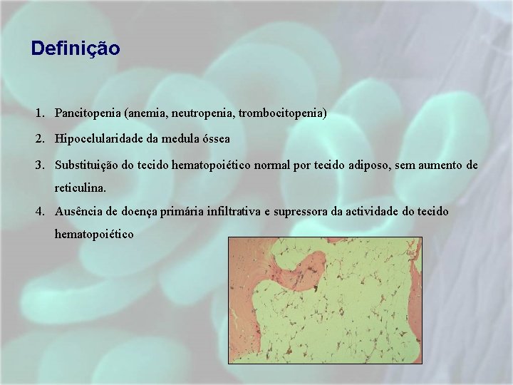Definição 1. Pancitopenia (anemia, neutropenia, trombocitopenia) 2. Hipocelularidade da medula óssea 3. Substituição do Definição 1. Pancitopenia (anemia, neutropenia, trombocitopenia) 2. Hipocelularidade da medula óssea 3. Substituição do