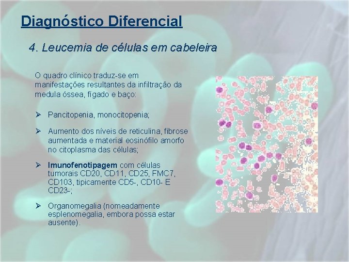 Diagnóstico Diferencial 4. Leucemia de células em cabeleira O quadro clínico traduz-se em manifestações Diagnóstico Diferencial 4. Leucemia de células em cabeleira O quadro clínico traduz-se em manifestações