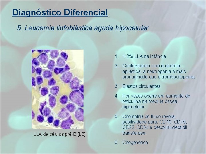 Diagnóstico Diferencial 5. Leucemia linfoblástica aguda hipocelular 1. 1 -2% LLA na infância 2. Diagnóstico Diferencial 5. Leucemia linfoblástica aguda hipocelular 1. 1 -2% LLA na infância 2.