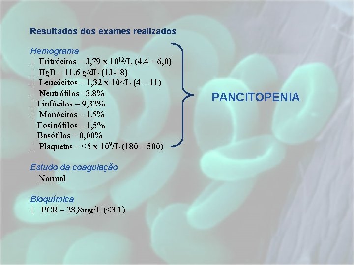 Resultados exames realizados Hemograma ↓ Eritrócitos – 3, 79 x 1012/L (4, 4 – Resultados exames realizados Hemograma ↓ Eritrócitos – 3, 79 x 1012/L (4, 4 –