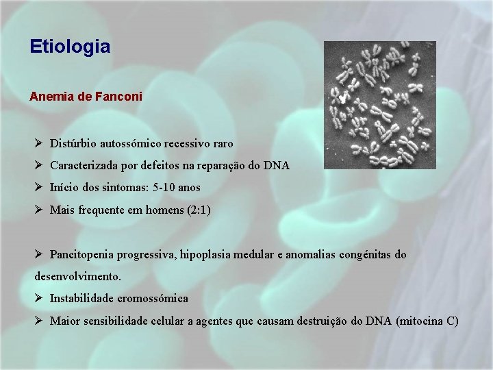 Etiologia Anemia de Fanconi Ø Distúrbio autossómico recessivo raro Ø Caracterizada por defeitos na Etiologia Anemia de Fanconi Ø Distúrbio autossómico recessivo raro Ø Caracterizada por defeitos na