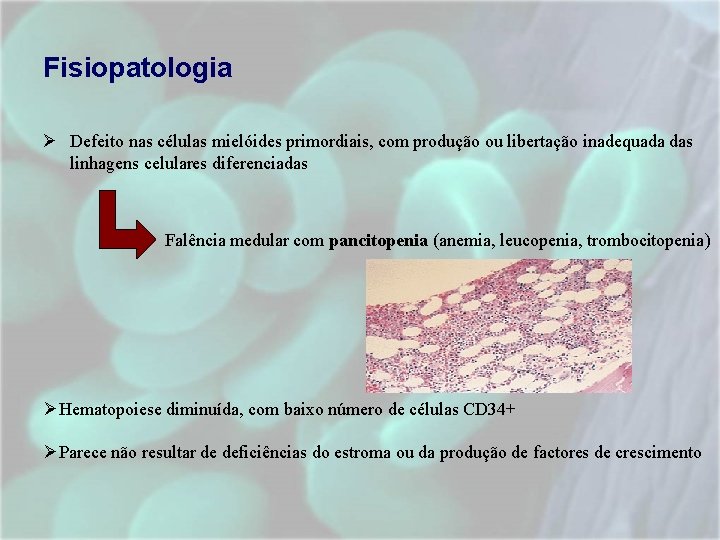 Fisiopatologia Ø Defeito nas células mielóides primordiais, com produção ou libertação inadequada das linhagens Fisiopatologia Ø Defeito nas células mielóides primordiais, com produção ou libertação inadequada das linhagens
