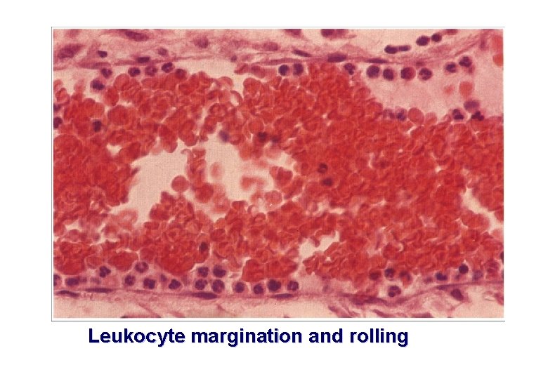 Leukocyte margination and rolling 