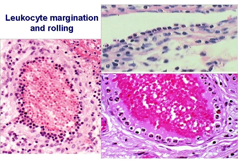 Leukocyte margination and rolling 