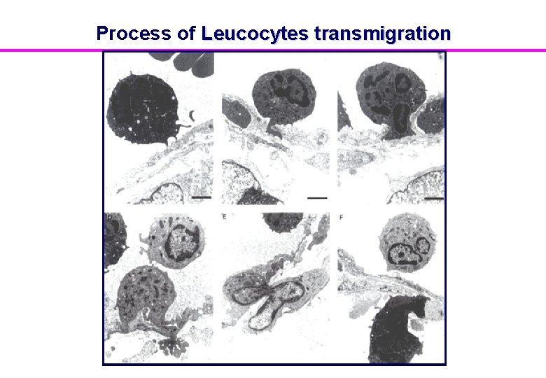 Process of Leucocytes transmigration 