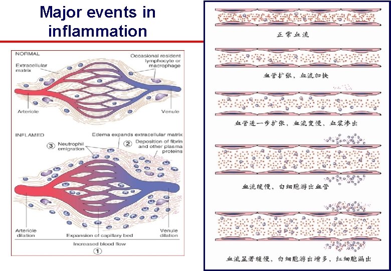 Major events in inflammation 