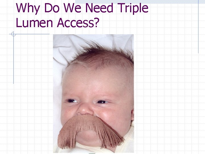 Why Do We Need Triple Lumen Access? 