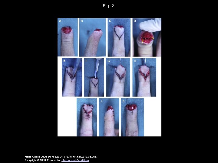 Fig. 2 Hand Clinics 2020 3619 -32 DOI: (10. 1016/j. hcl. 2019. 08. 003)
